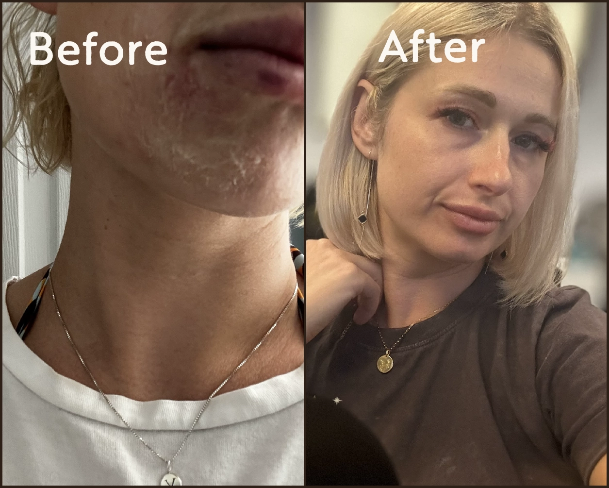 Before and after portrait photos of a woman