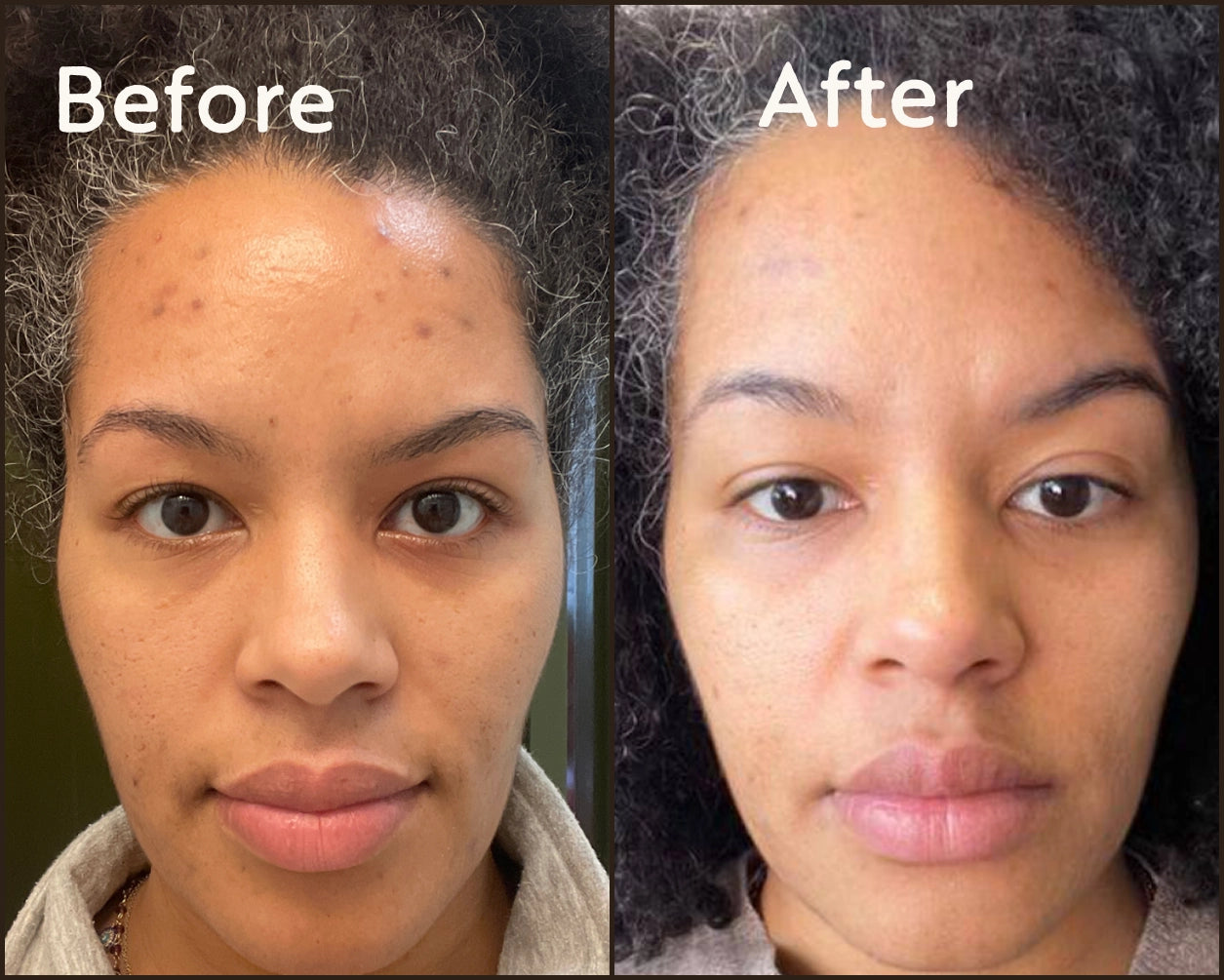Before and after portrait photos of a woman